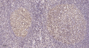 eIF2β rabbit pAb