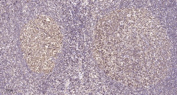 eIF2 beta antibody