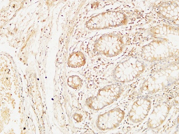 Bcl-10 antibody