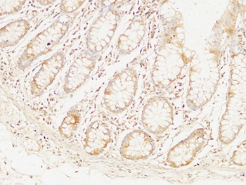 Bcl-10 antibody