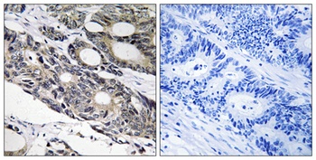 Bcl-10 antibody