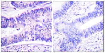 WAVE1 (phospho Tyr125) rabbit pAb