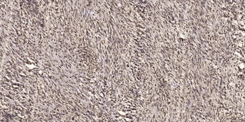 Cyclin D2 (phospho Thr280) rabbit pAb