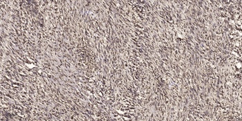 Cyclin D2 (phospho-Thr280) antibody