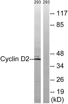 Cyclin D2 rabbit pAb