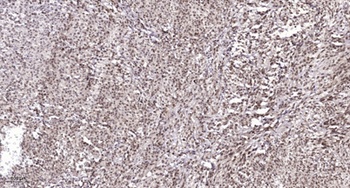 Cyclin E1 (phospho Thr77) rabbit pAb