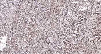 Cyclin E1 (phospho-Thr77) antibody