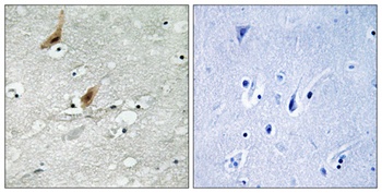 MSK2 (phospho Thr568) rabbit pAb