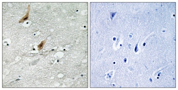 MSK2 (phospho-Thr568) antibody