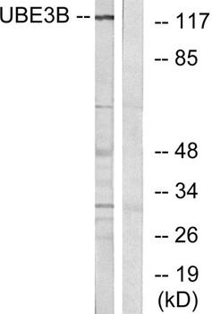 UBE3B rabbit pAb Antibody