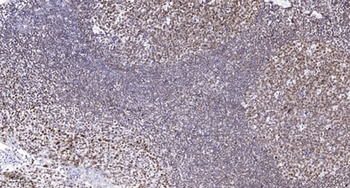 UBE3B antibody