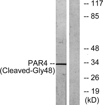 Cleaved-PAR-4 (G48) antibody
