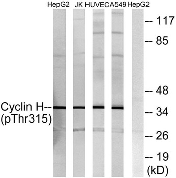 Cyclin H (phospho-Thr315) antibody