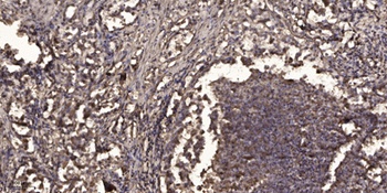 Ribosomal Protein L14 rabbit pAb