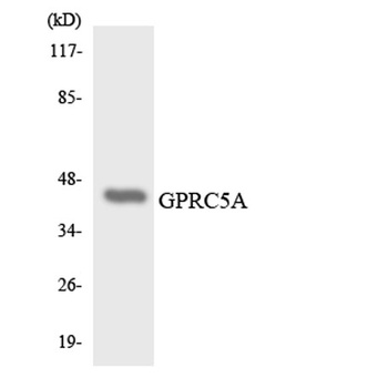 RAI3 antibody