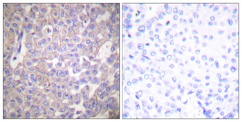 Claudin-2 antibody