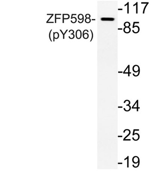 ZFP598 (phospho-Tyr306) antibody