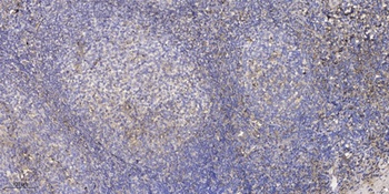 ZFP598 (phospho Tyr306) rabbit pAb