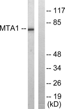 MTA1 rabbit pAb Antibody