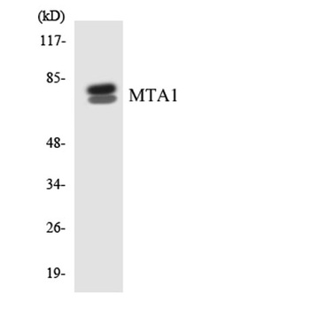 MTA1 antibody