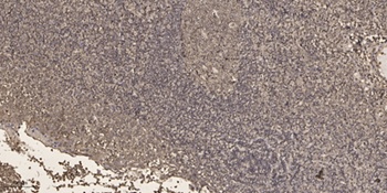 MTA1 antibody