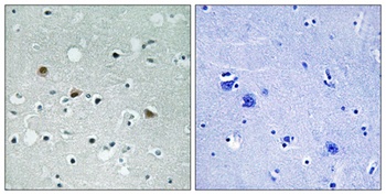 LATS1/2 (phospho Thr1079/1041) rabbit pAb
