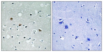 LATS1/2 (phospho-Thr1079/1041) antibody