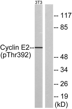 Cyclin E2 (phospho-Thr392) antibody