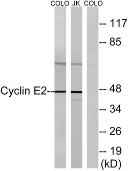 Cyclin E2 antibody