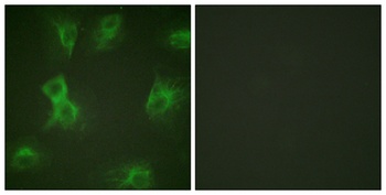 Hrs (phospho Tyr334) rabbit pAb