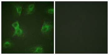 Hrs (phospho-Tyr334) antibody