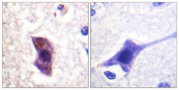 Hrs (phospho Tyr334) rabbit pAb