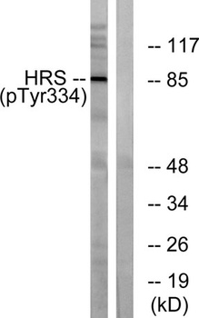 Hrs (phospho Tyr334) rabbit pAb