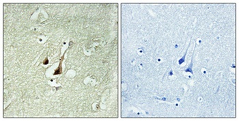Dyrk1B rabbit pAb Antibody