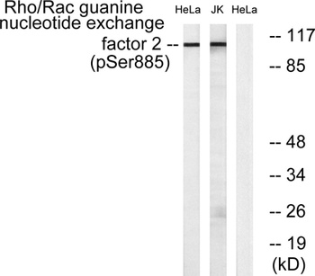 Lfc (phospho Ser886) rabbit pAb