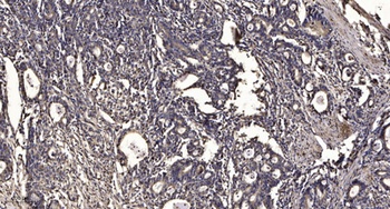 Arrdc4 antibody