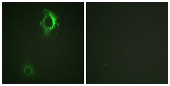 CD5 (phospho Tyr453) rabbit pAb
