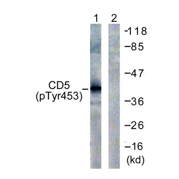 CD5 (phospho-Tyr453) antibody