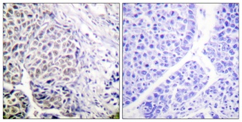 ARK-2 (phospho Tyr12) rabbit pAb