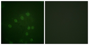 ARK-2 (phospho-Thr232) antibody