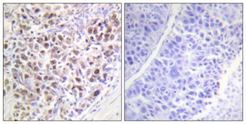 ARK-2 (phospho Thr232) rabbit pAb