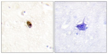 ARK-2/3 (phospho Thr236/202) rabbit pAb