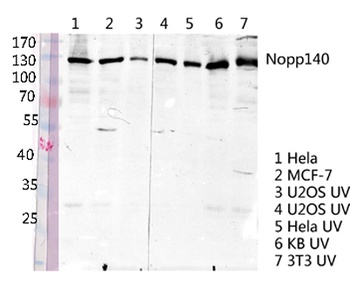 Nopp140 rabbit pAb