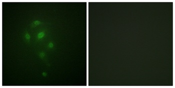 MSK1 (phospho Thr581) rabbit pAb