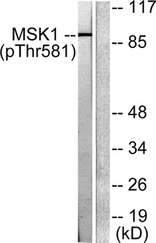 MSK1 (phospho Thr581) rabbit pAb