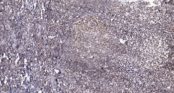 MSK1 (phospho-Thr581) antibody