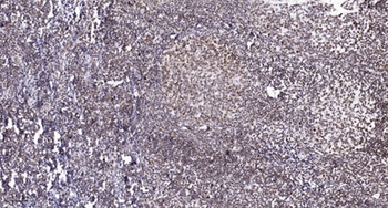 MSK1 (phospho Thr581) rabbit pAb