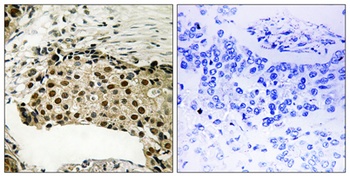 MSK1 (phospho Ser212) rabbit pAb