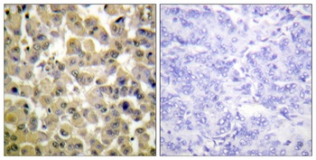 MSK1 (phospho Ser360) rabbit pAb