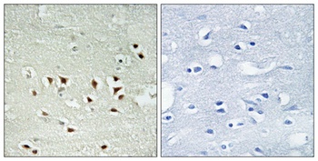 MAPKAPK-2 (phospho Thr334) rabbit pAb